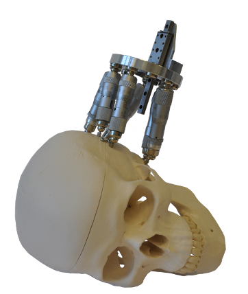 Gough-Stewart platform (Hexapod) on the skull